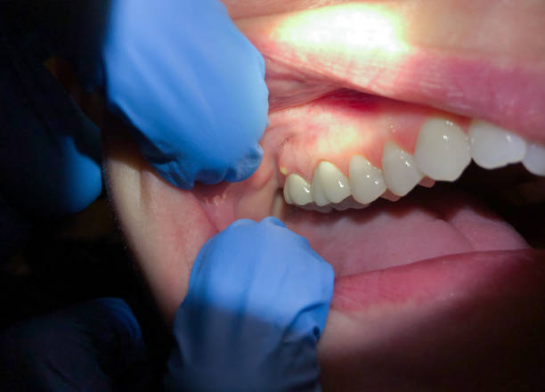 Best Emergency Treatment for Toothache in Highspire, PA