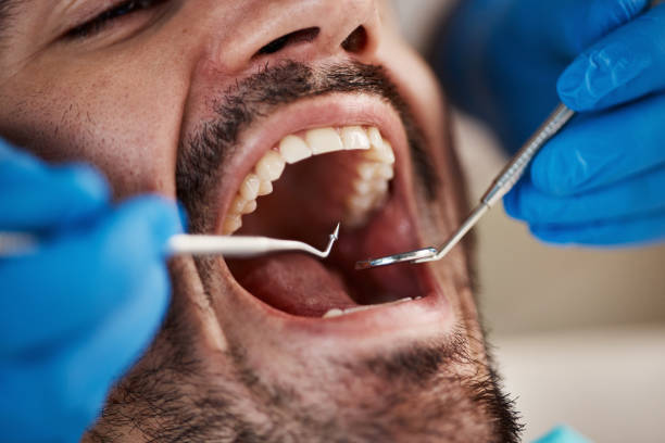 Best Emergency Broken Tooth Repair in Highspire, PA